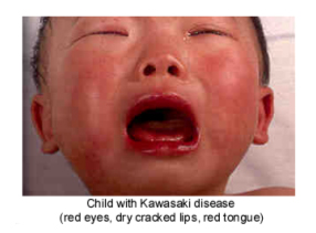 �������� KAWASAKI (1).jpg